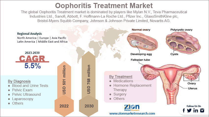 Oophoritis Treatment Market Size