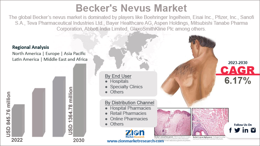 Global Becker's Nevus Market Size