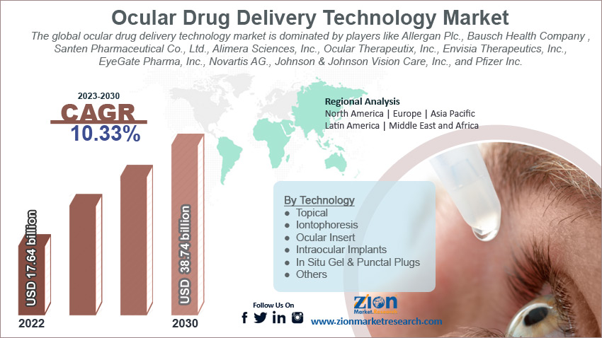 Global Ocular Drug Delivery Technology Market Size