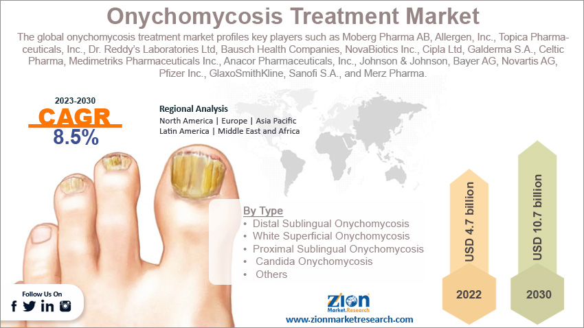 Global Onychomycosis Treatment Market Size