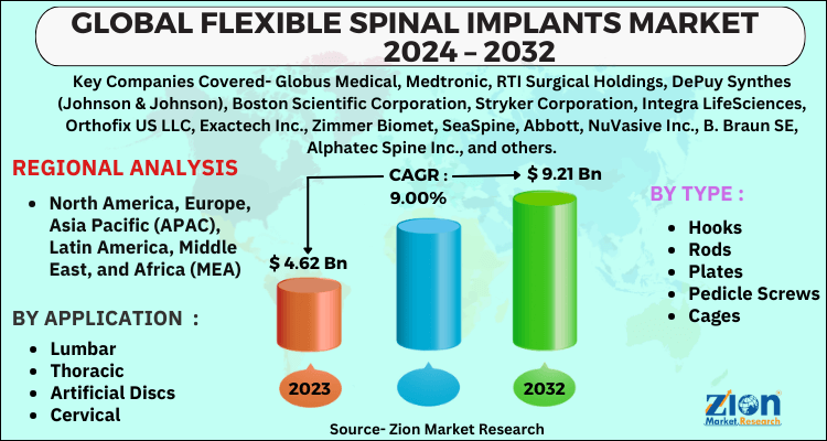 Flexible Spinal Implants Market