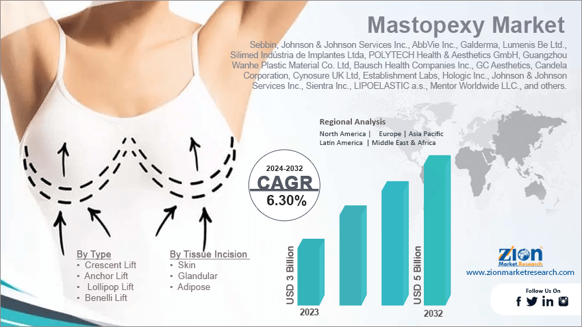 Mastopexy Market