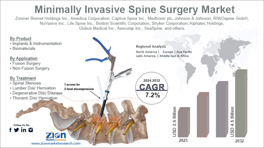 Minimally Invasive Spine Surgery Market