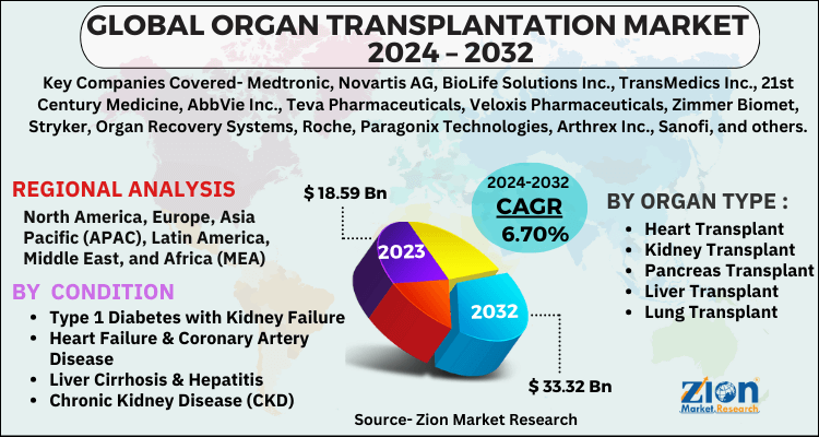 Organ Transplantation Market