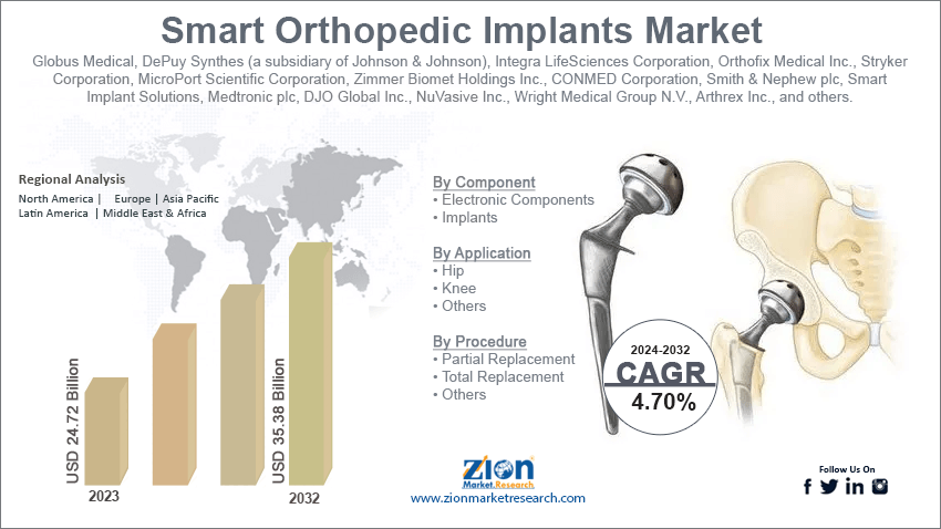 Smart Orthopedic Implants Market