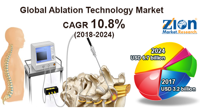 Global Ablation Technology Market