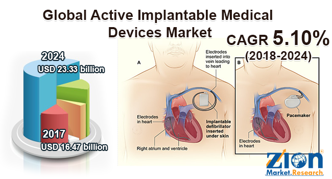 Global Active Implantable Medical Devices Market