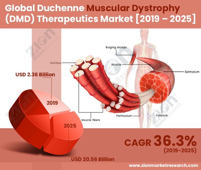 Global Duchenne Muscular Dystrophy (DMD) Therapeutics Market