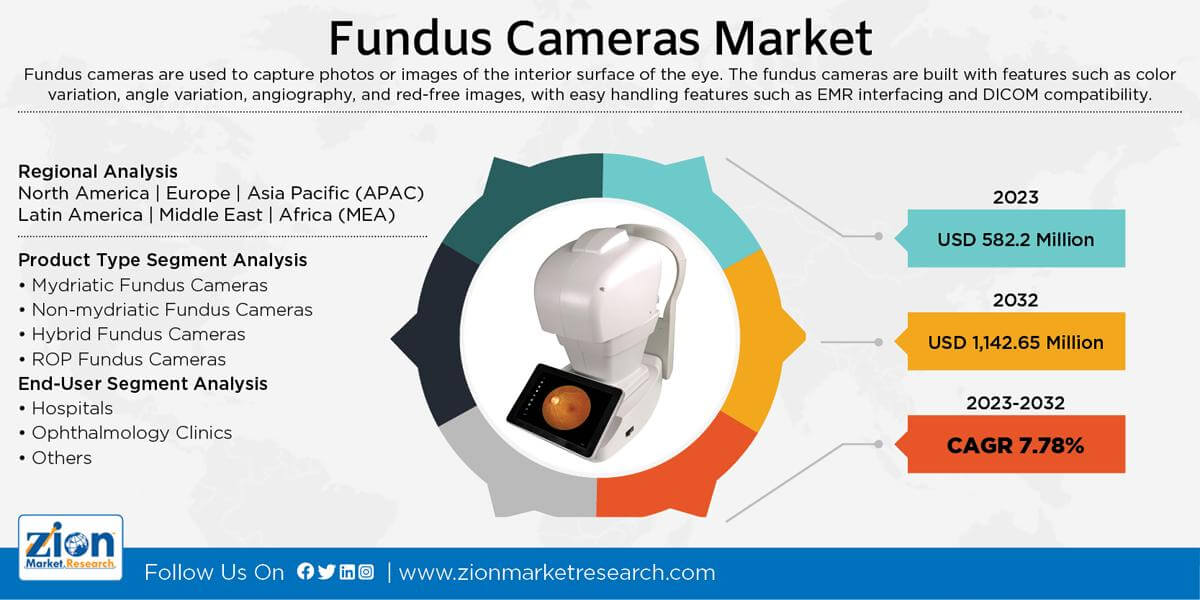 Global Fundus Cameras Market