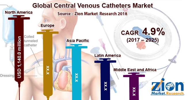 Global Central Venous Catheters Market