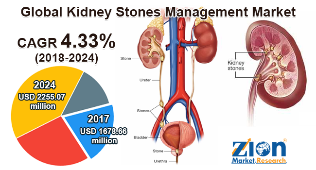 /Kidney-Stones-Management-Market