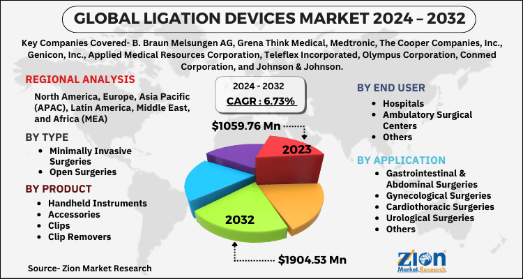 Ligation Devices Market