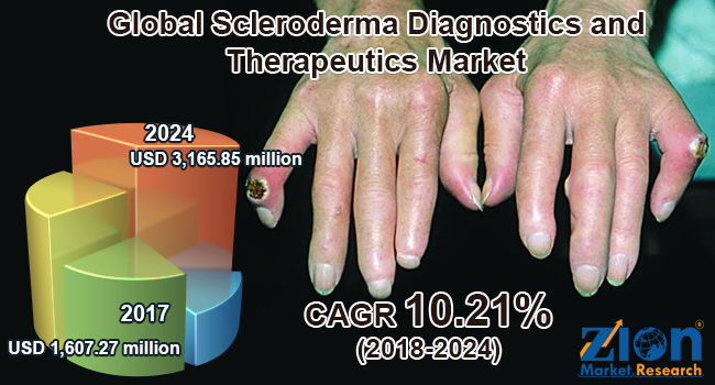 Global Scleroderma Diagnostics and Therapeutics Market