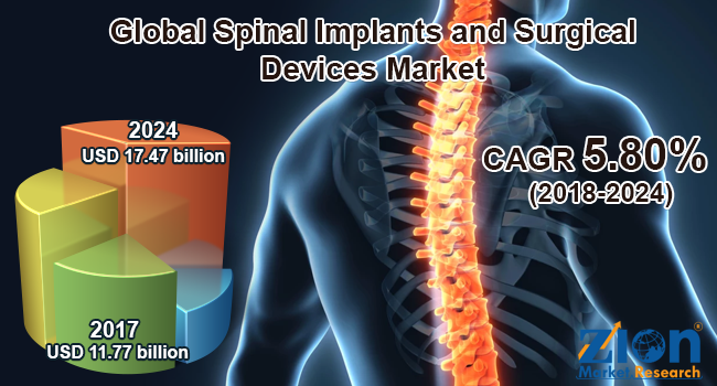 Global Spinal Implants and Surgical Devices Market