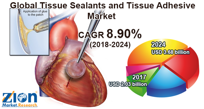 Global Tissue Sealants and Tissue Adhesive Market