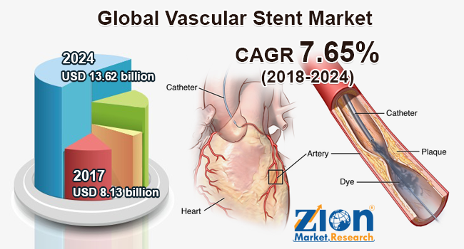 Global Vascular Stent Market