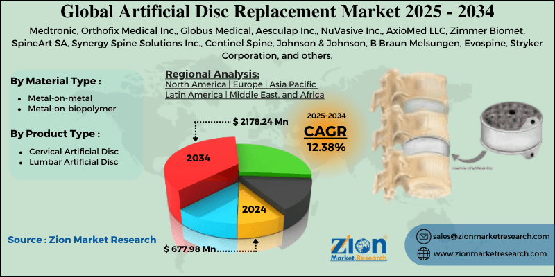 Artificial Disc Replacement Market