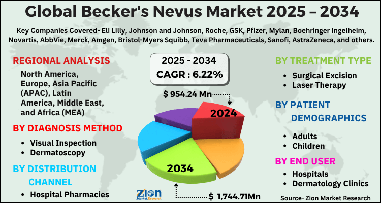Becker's Nevus Market