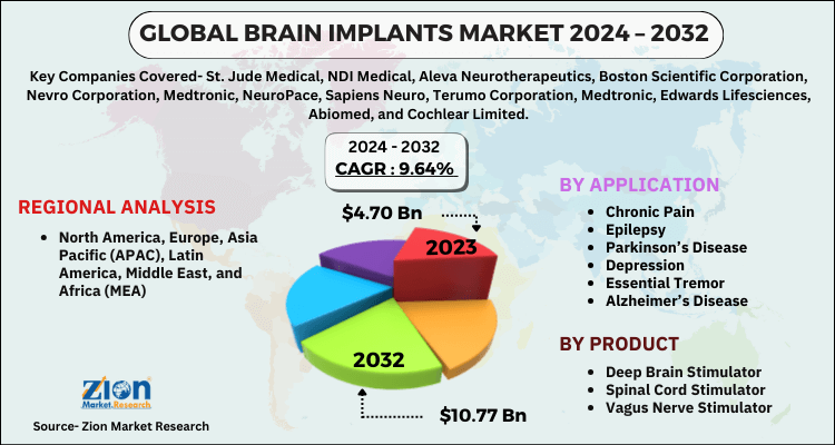 Brain Implants Market