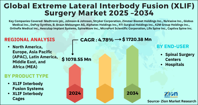 Extreme Lateral Interbody Fusion (XLIF) Surgery Market