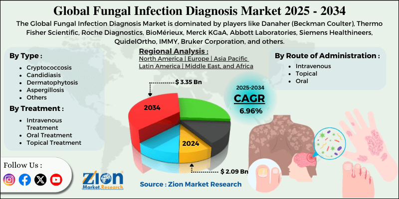 Fungal Infection Diagnosis Market