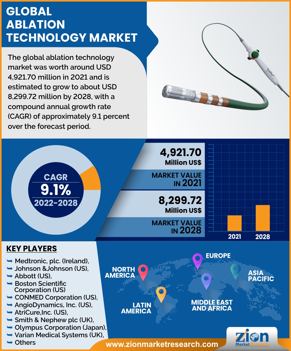Global Ablation Technology Market