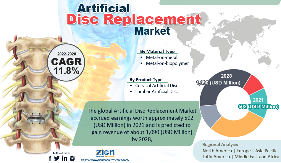 Artificial Disc Replacement Market