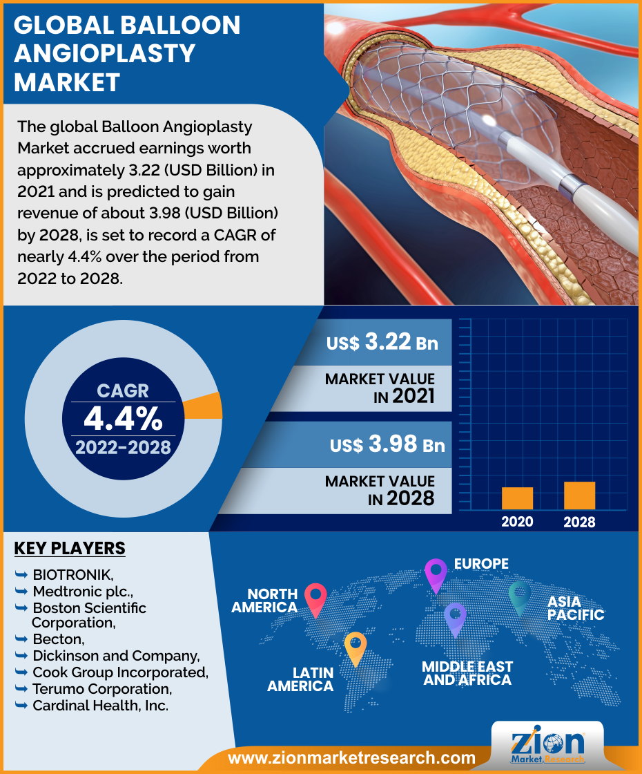 Global Balloon Angioplasty Market