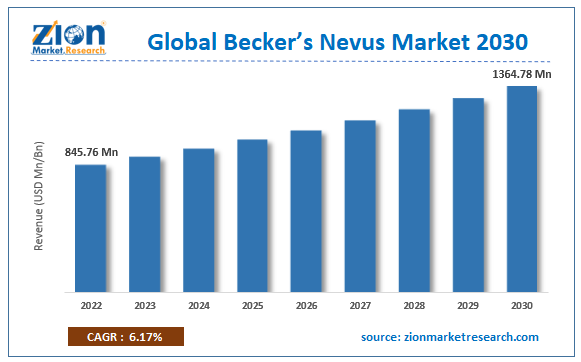 Global Becker’s Nevus Market Size