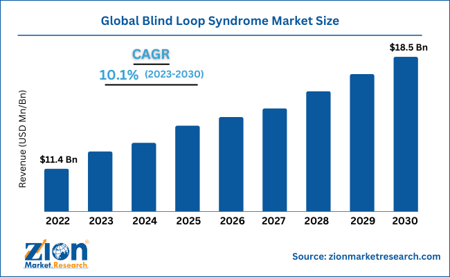 Global Blind Loop Syndrome Market Size