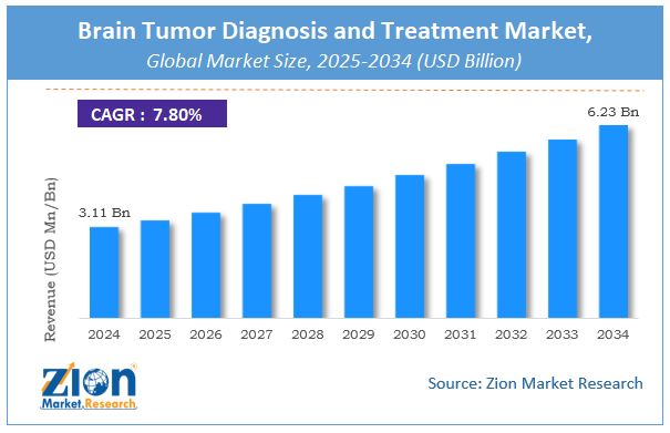 Global Brain Tumor Diagnosis and Treatment Market Size
