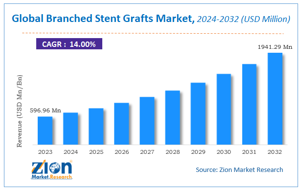 Branched Stent Grafts Market Size