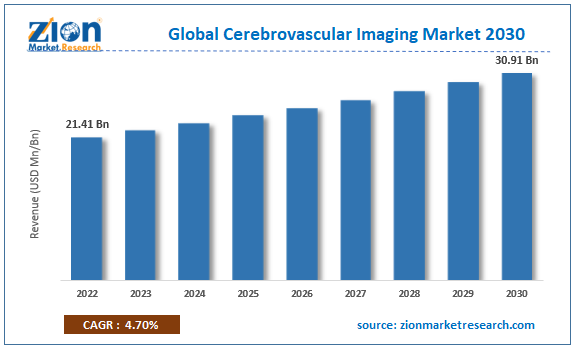 Global Cerebrovascular Imaging Market Size