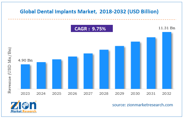 Global Dental Implants Market Size