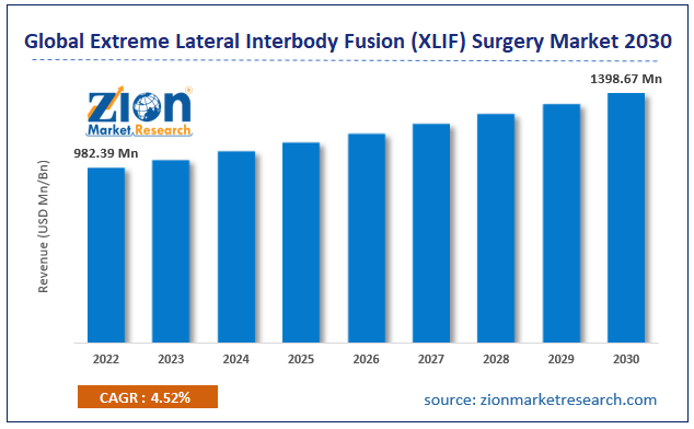 Global Extreme Lateral Interbody Fusion (XLIF) Surgery Market Size