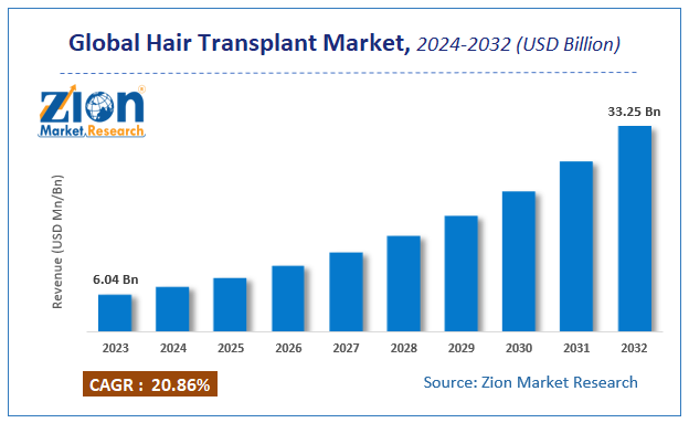 Global Hair Transplant Market Size
