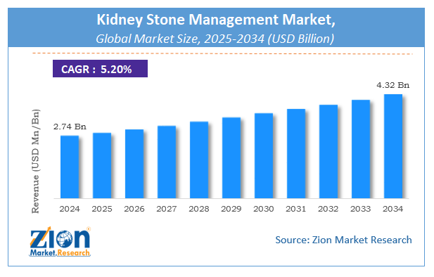 Global Kidney Stone Management Market Size