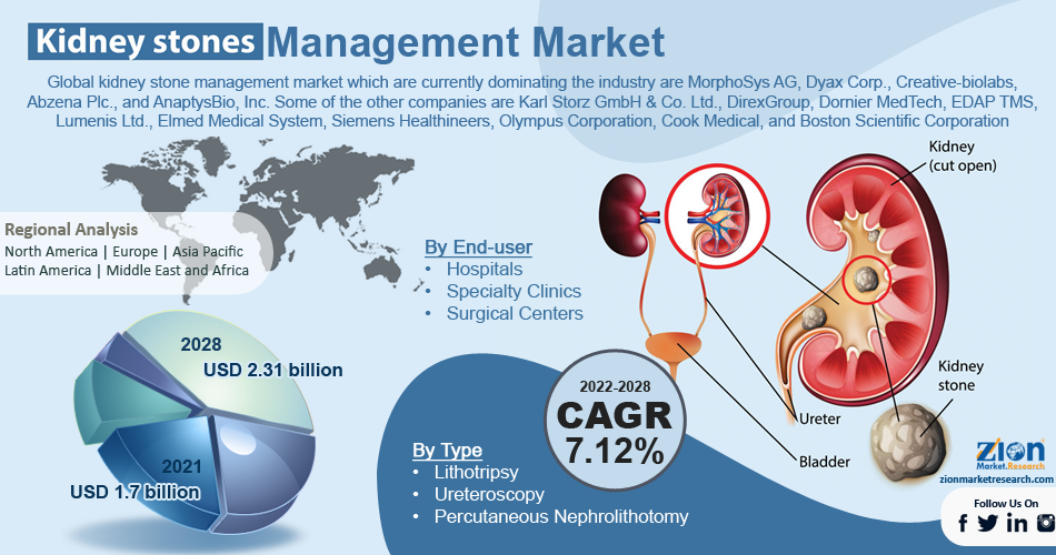 Global Kidney Stone Management Market