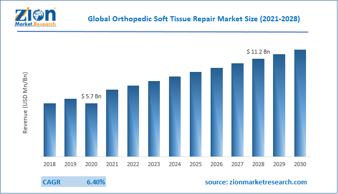 Global Orthopedic Soft Tissue Repair Market Size
