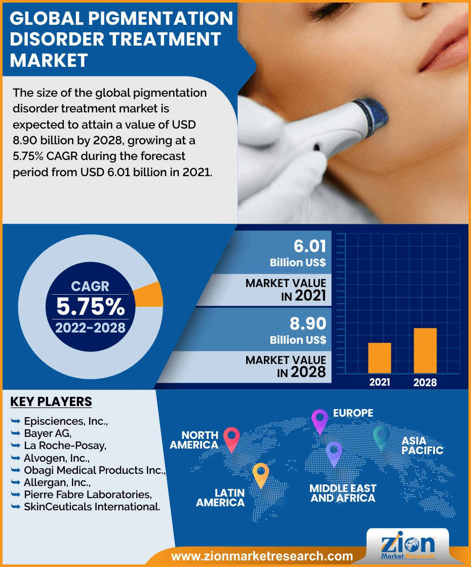 Global Pigmentation Disorder Treatment Market