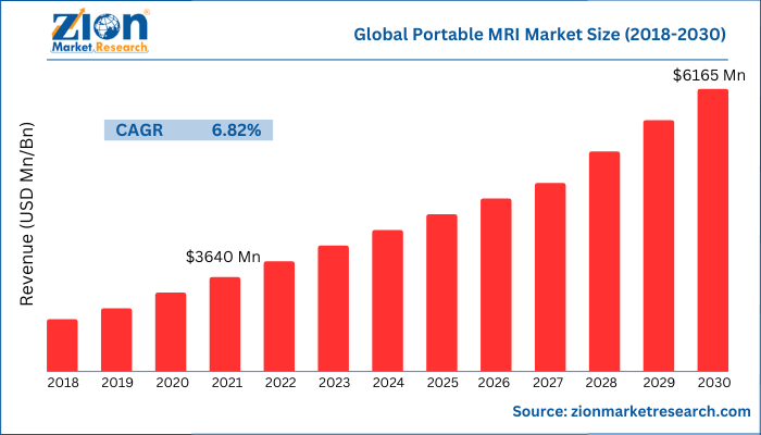 Global Portable MRI Market Size