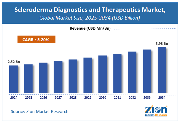 Global Scleroderma Diagnostics and Therapeutics Market Size