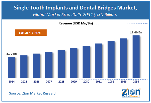 Global Single Tooth Implants and Dental Bridges Market Size