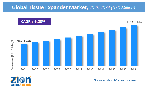 Global Tissue Expander Market Size