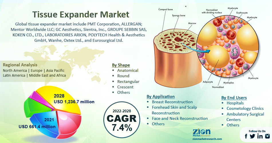 Global Tissue Expander Market
