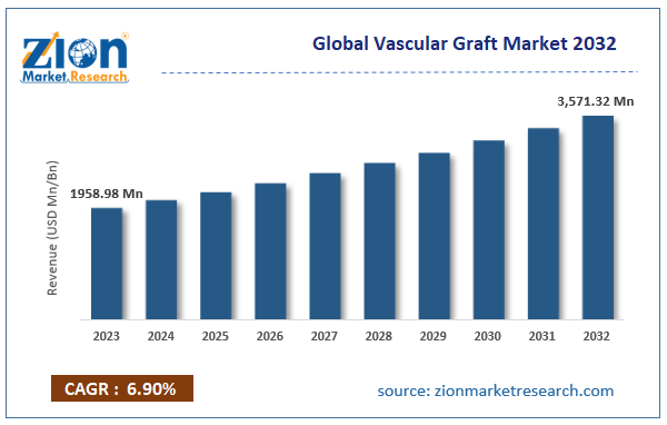 Vascular Graft Market Size