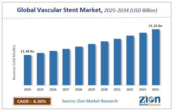 Global  Vascular Stent Market Size