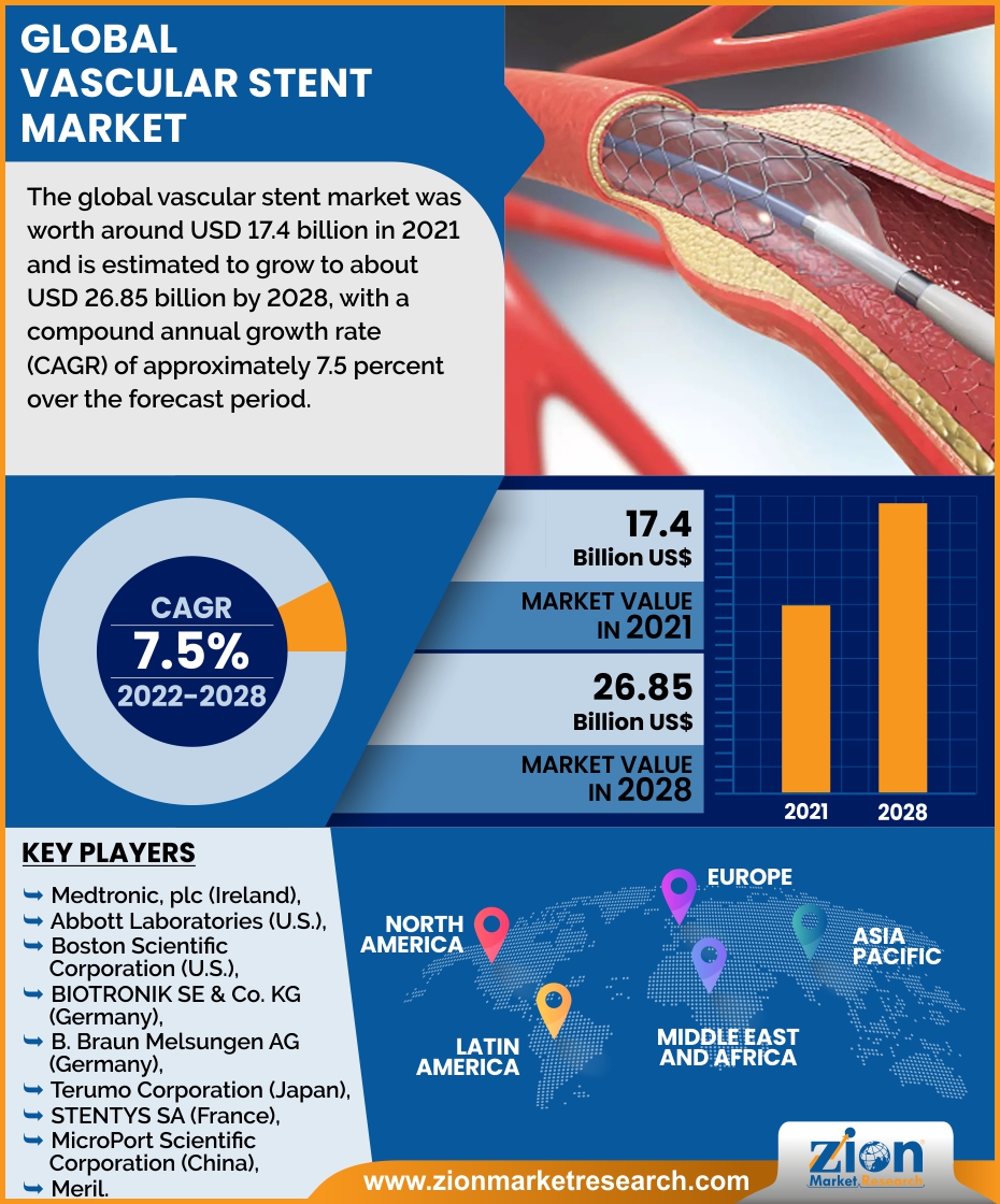 Global Vascular Stent Market