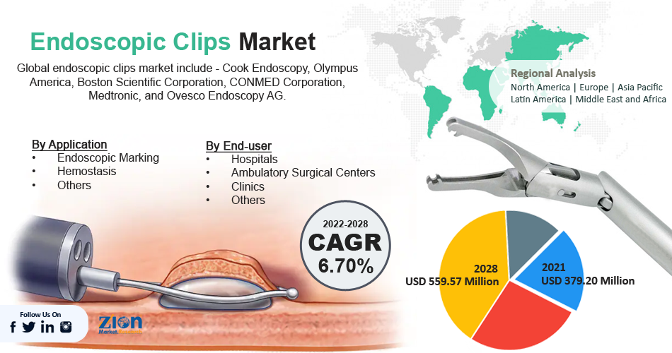 Global Endoscopic Clips Market
