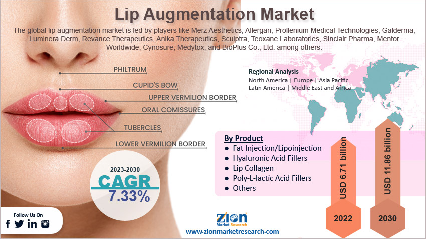 Global Lip Augmentation Market Size